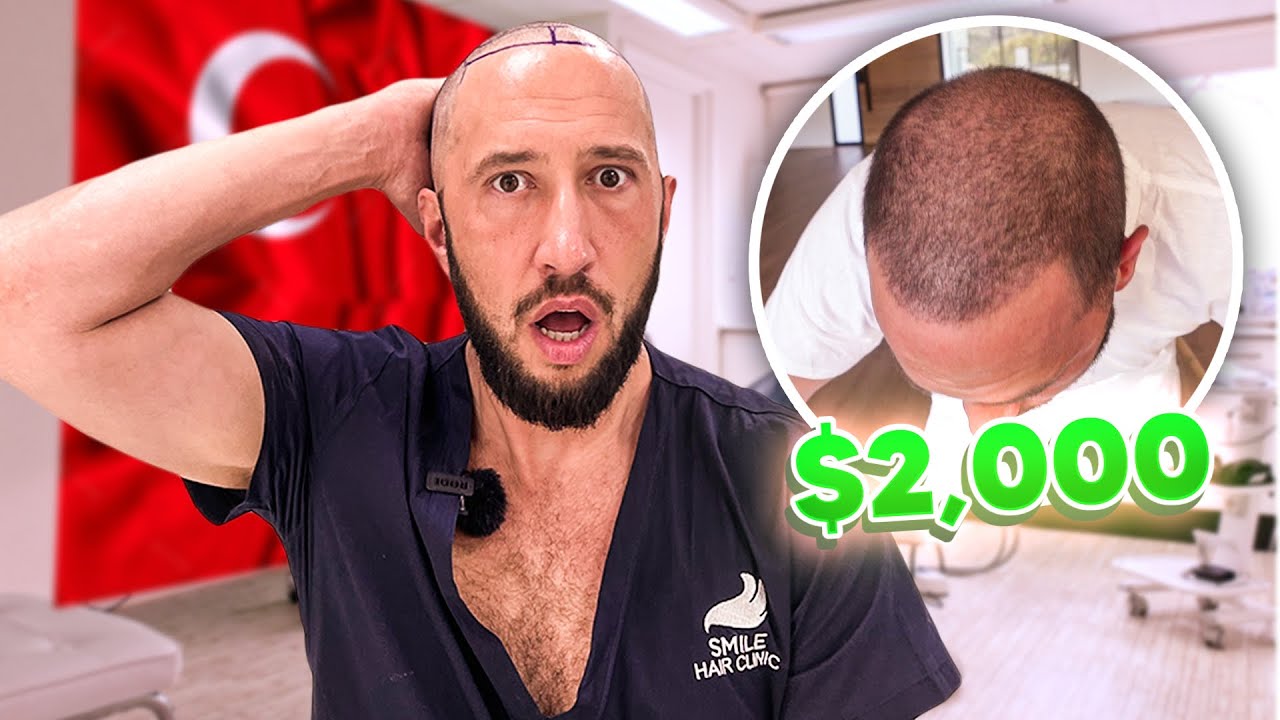 Mike Majlak’s Hair Transplant Modena Hair Institute