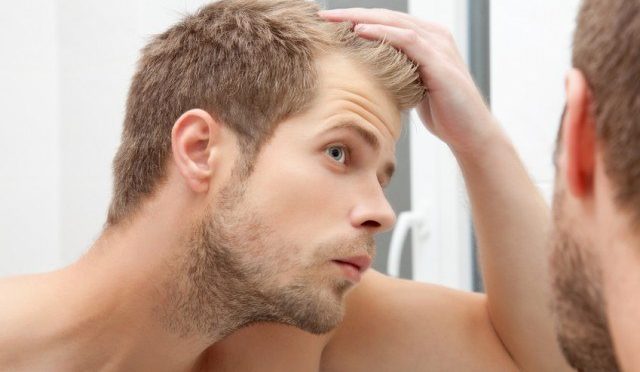 How to determine how many grafts you need for hair transplant surgery