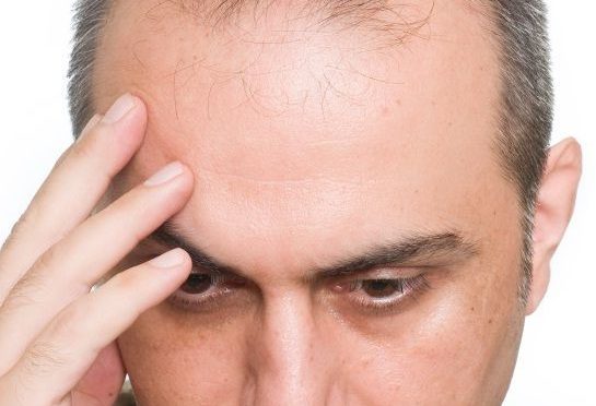 Depression caused by hair loss