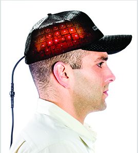 Laser therapy for hair loss