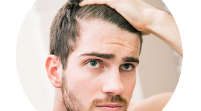 How Hair Transplants Can Fix an Uneven or Thinning Hairline