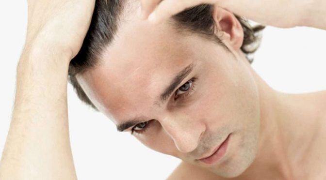 Hair Restoration Surgery for Younger Patients