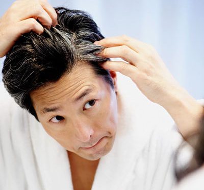 Reasons You’re Prematurely Graying