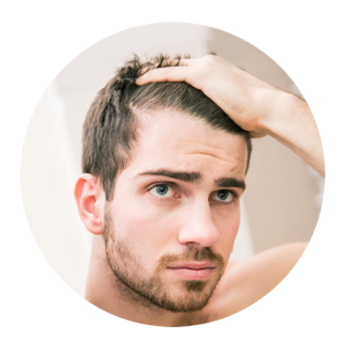 Hair Loss Prevention Shampoo