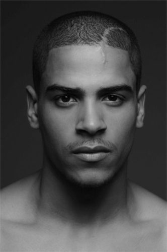 men with facial scars Huge black dicks being sucked