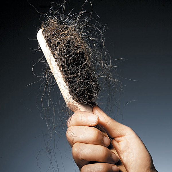 Does hair shedding play a role in hair loss? Modena Hair Does hair shedding play a role in hair loss? Modena Hair
