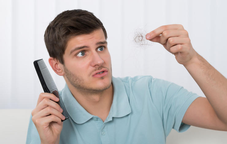 hair loss telogen effluvium