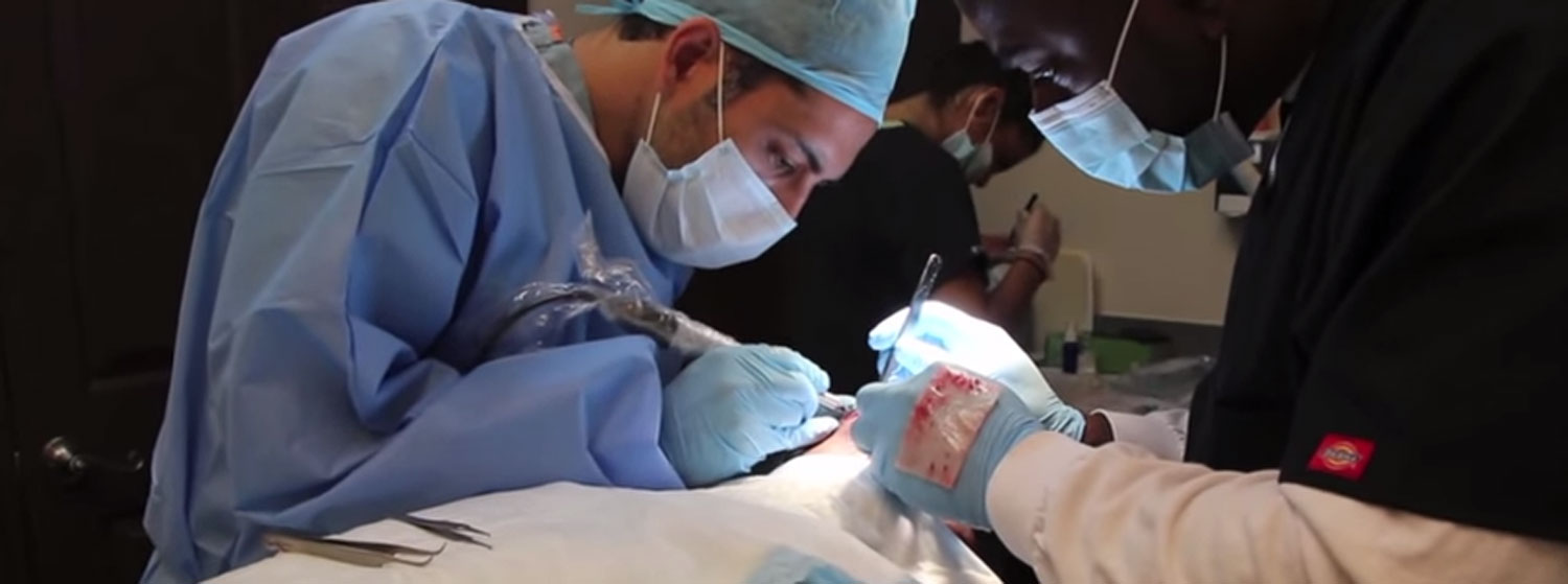 Hair Transplants in 2019 Modena Hair Institute