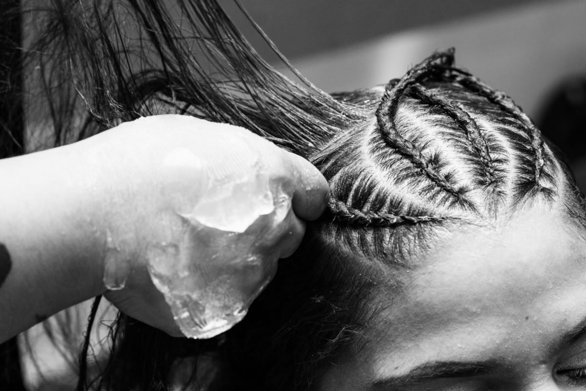 traction alopecia