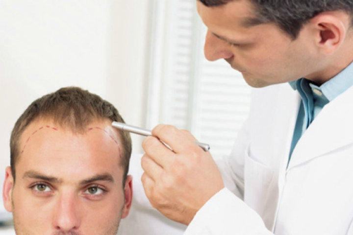 hair transplant orange county