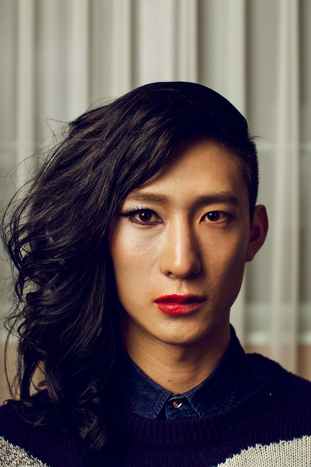 Transgender Hair Transplants Modena Hair Institute